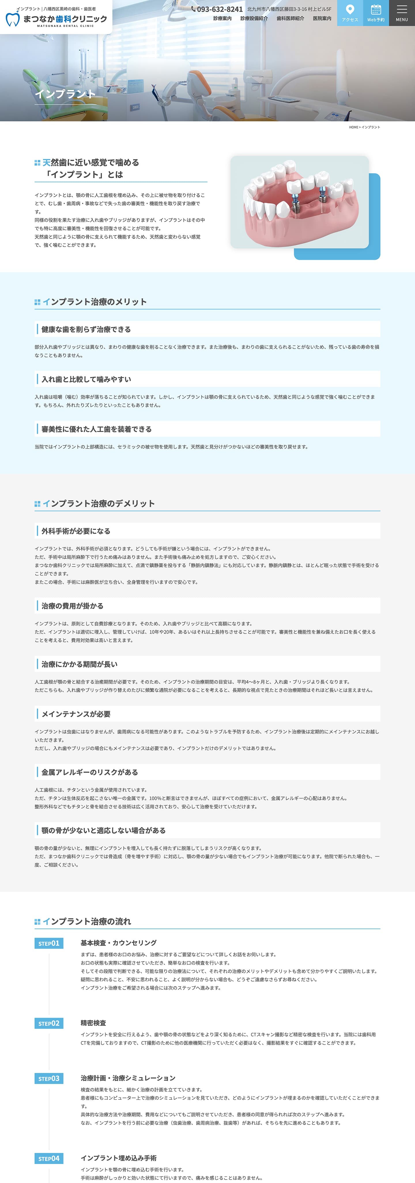 インプラント｜八幡西区黒崎に新規開業の歯医者様サイト｜まつなか歯科クリニック様